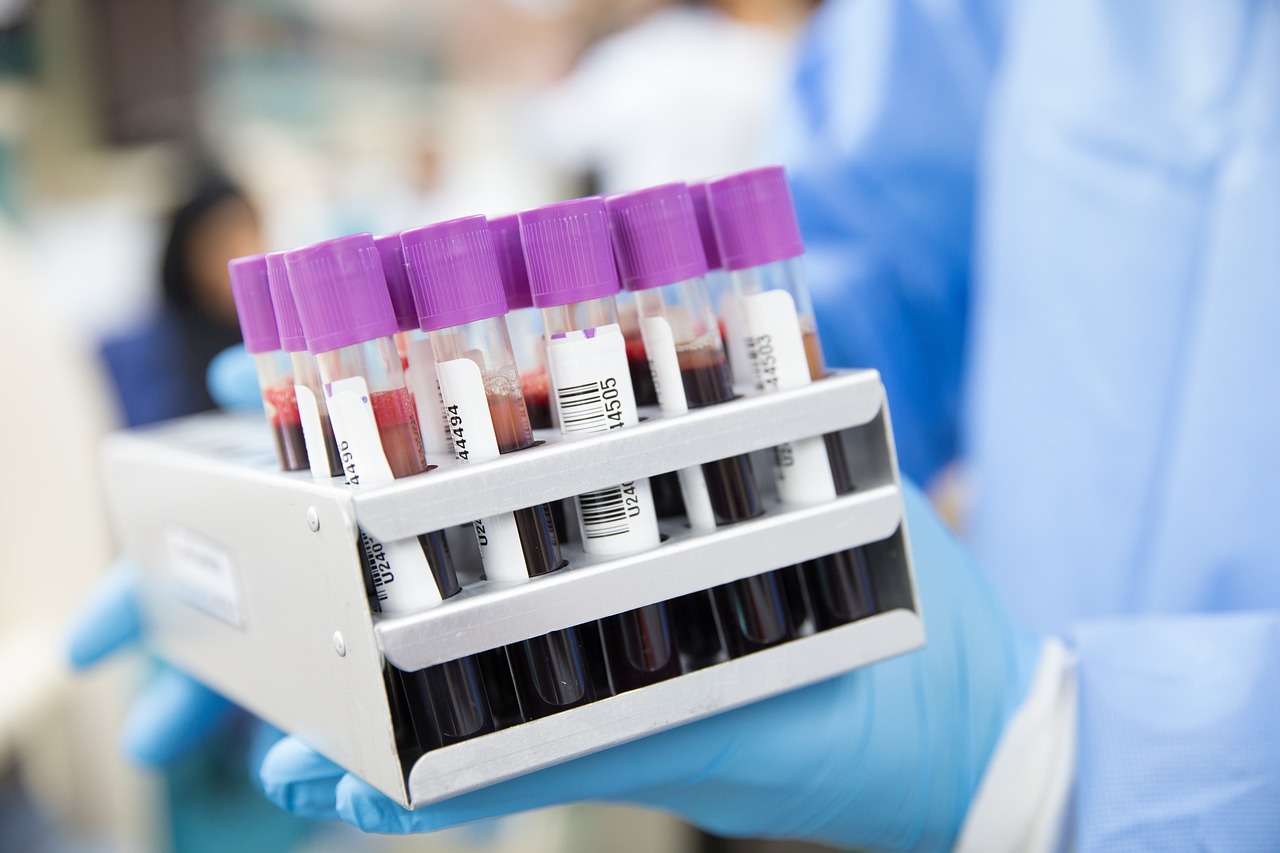 sample, lab, laboratory, scientist, medical, health, test, science, healthcare, research, tube, blue health, blue medical, blue science, blue research, blue lab, blue test, blue blood, blue laboratory, blue healthcare